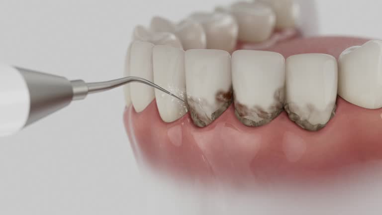 Trusted Wisdom Tooth Removal service in Searcy, AR - Dentist Open Now
